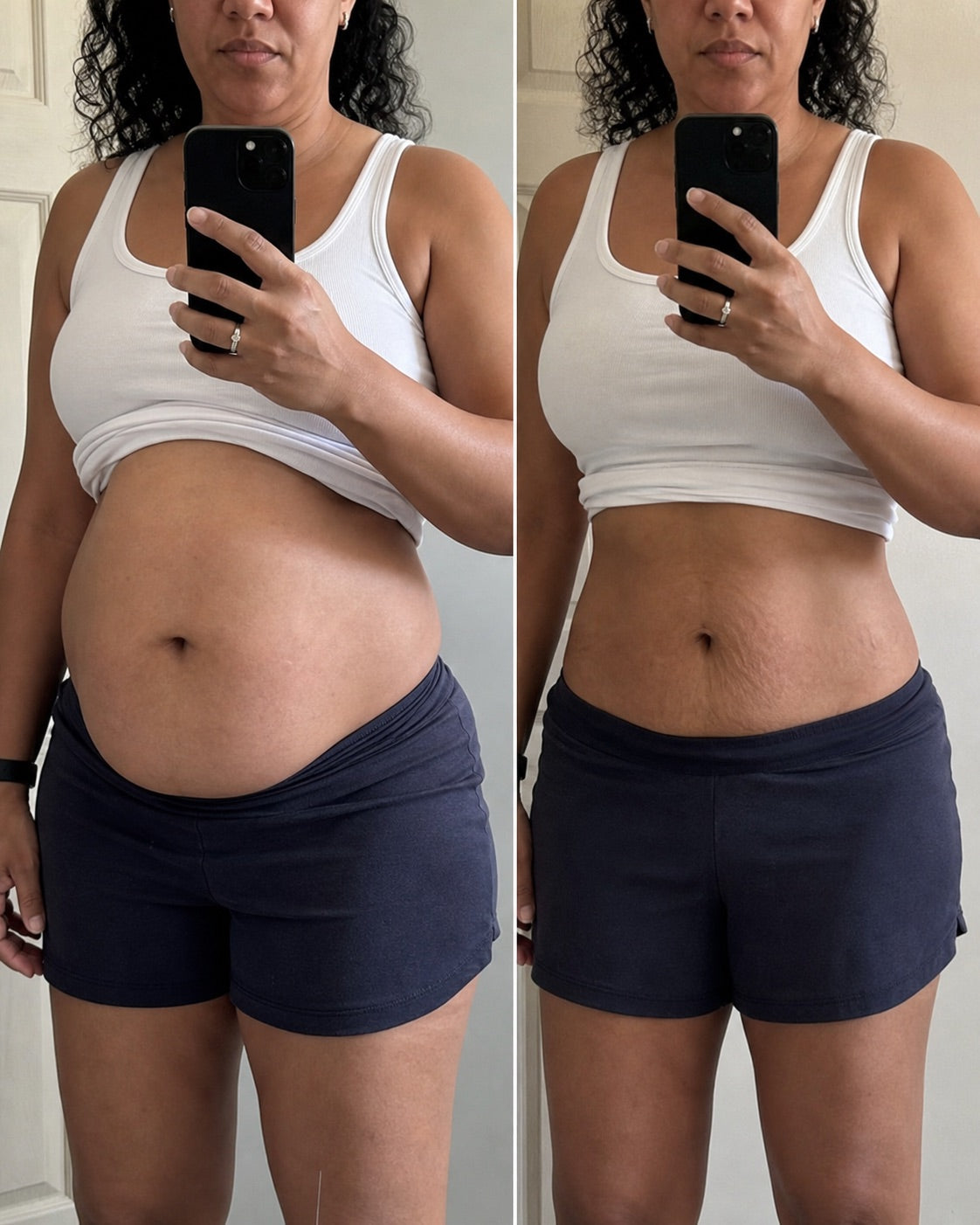 Illustrative abdominal before and after comparison for an independent routine story