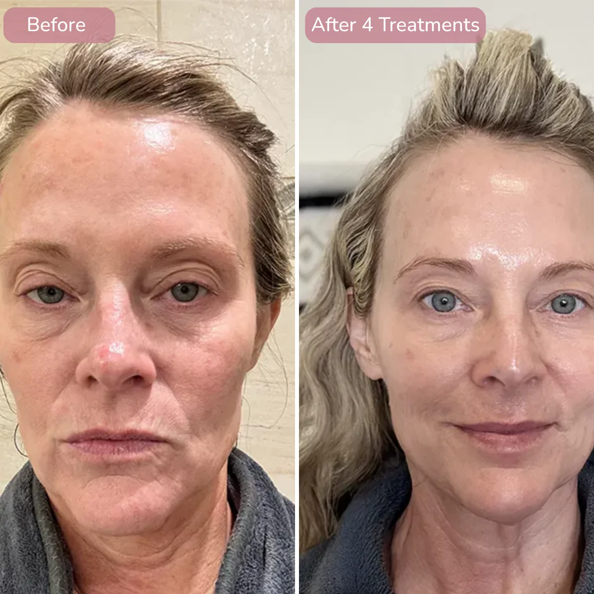 Internal NMN concept comparison at six weeks