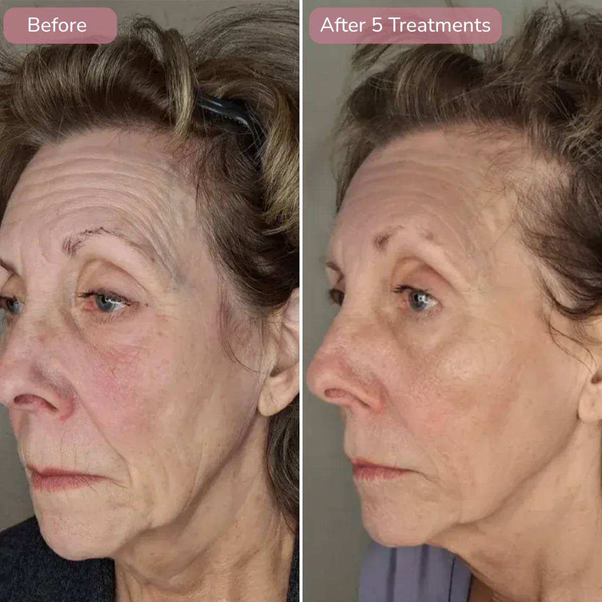 Internal NMN concept comparison at eight weeks